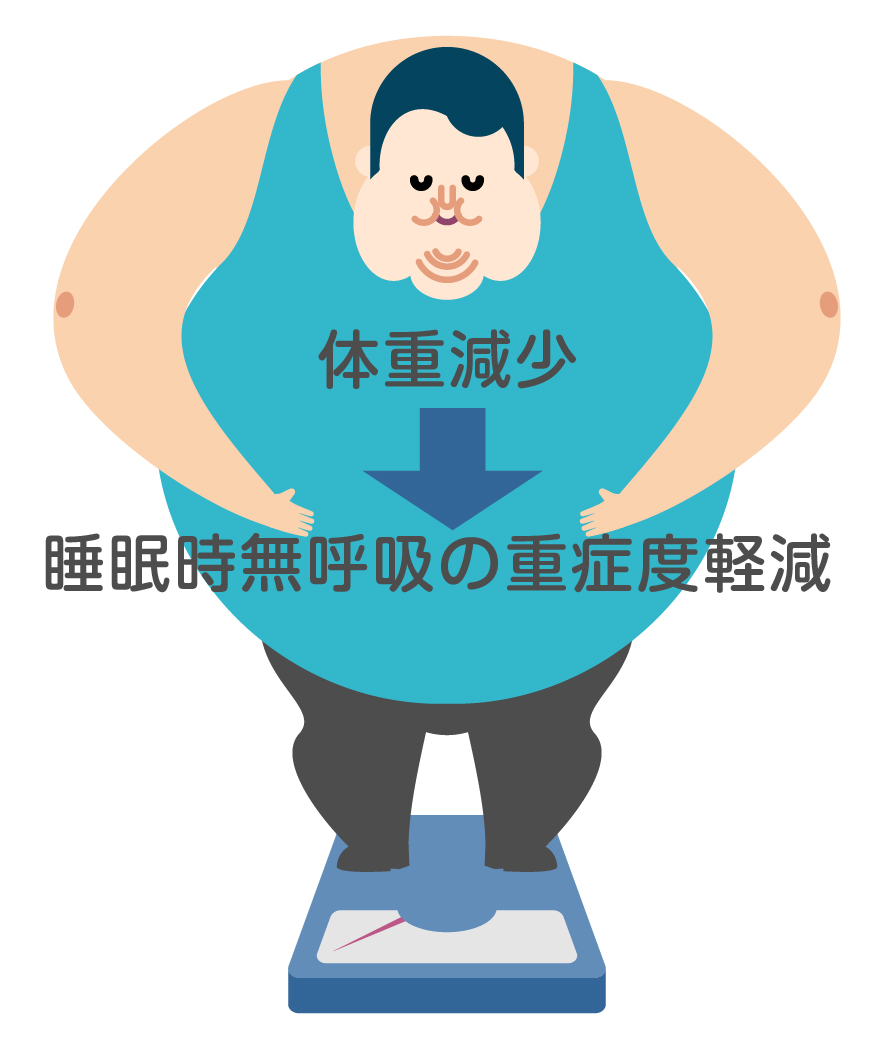 星野耳鼻咽喉科で行っているGLP-1受容体作動薬「リベルサス®」を用いた睡眠時無呼吸症候群のの自由診療